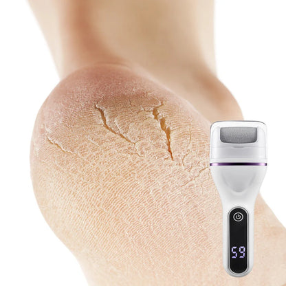 ✨Portable Electric Foot Callus Remover - Quick & Efficient Dead Skin Removal
