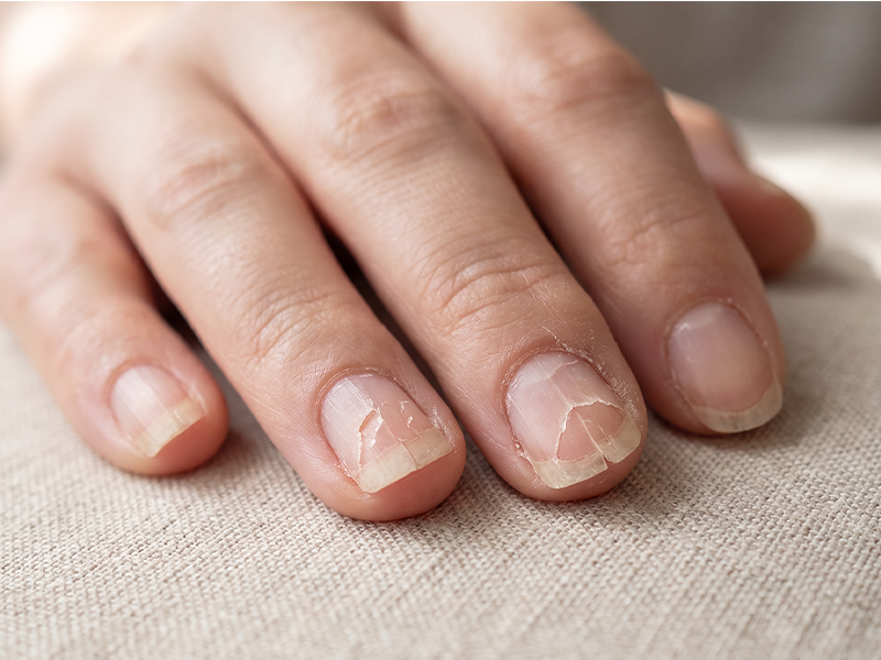 Weak Nails Break Easily