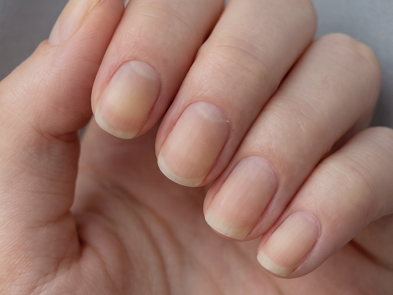 Dull Nails Lack Shine