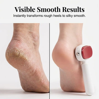 ✨📢LAST DAY SALE: Only ￡6.99!!!🔥Double-Sided Foot Scraper for Callus Removal